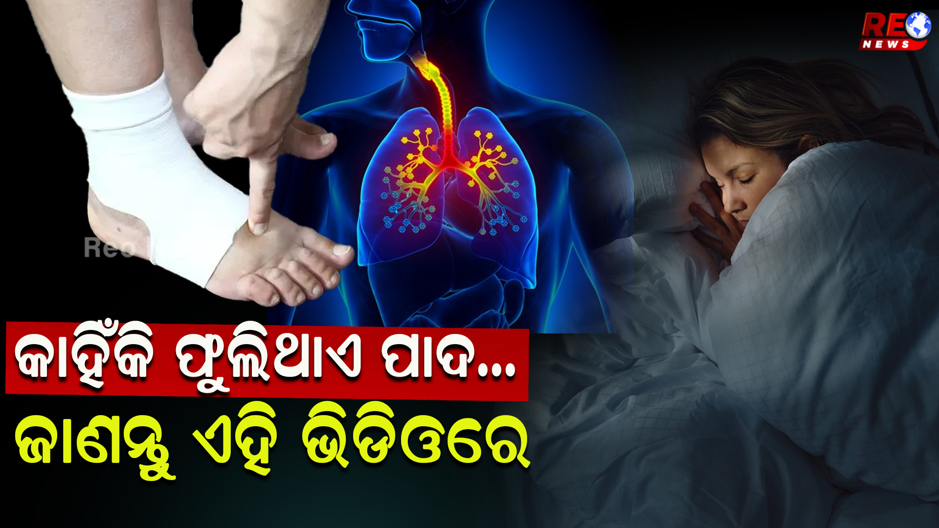 କାହିଁକି ଫୁଲିଥାଏ ପାଦ…
