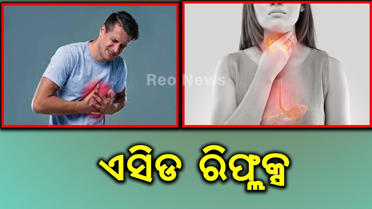 ଏସିଡ ରିଫ୍ଲକ୍ସ